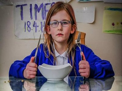 Alimləri şoka salan 13 yaşlı qız - Dünyada ilk dəfə...