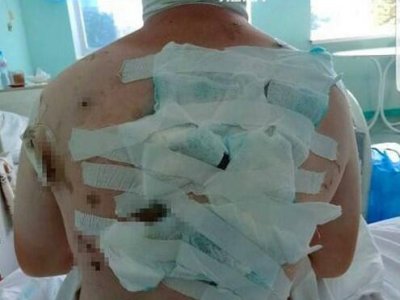 70 yerindən bıçaqlanan şagird danışdı