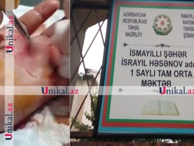 Şagird sinif yoldaşını yaraladı, sinif rəhbəri hadisəni gizlətdi - Səs yazısı