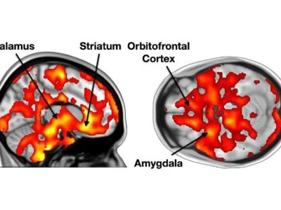 Musiqilərin beynə təsiri- TƏDQİQAT