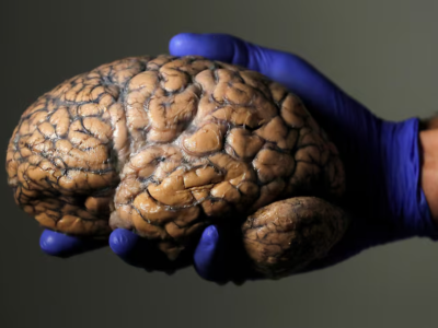 Alimlər beyin inkişafını izləyən atlas təqdim etdilər