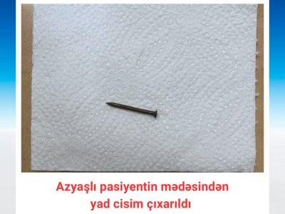 Bakıda azyaşlının mədəsindən mismar çıxarıldı -&nbsp;FOTO
