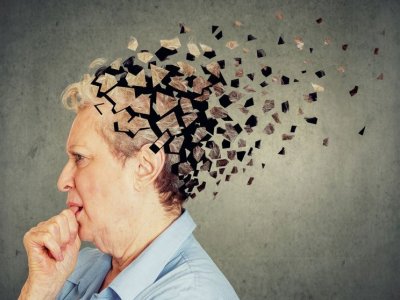 Alzheimer xəstəliyi başlamadan dayandırıla bilər