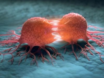 Uşaqlara edilən səhvlər 30 yaşdan sonra xərçəng riskini artırır