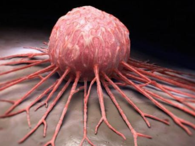 Yuxu siqnalları xərçəng və ürək xəstəliklərini öncədən göstərə bilər