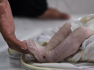 Qəzzada 7 aylıq körpə soyuqdan həyatını itirdi