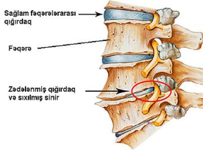 Qığırdaq toxumasının bərpası mümkün oldu