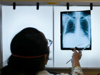 24 mart Beynəlxalq Vərəmlə Mübarizə günüdür