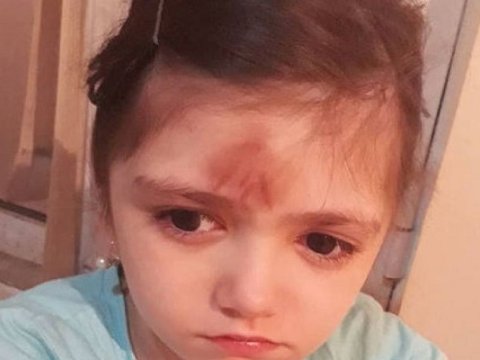 “Xətkeş qalxıb uşağın alnına dəyib” – Döyülən  şagirdlə bağlı rəsmi açıqlama