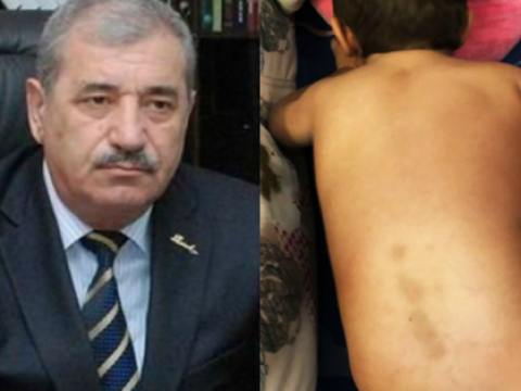 Keçmiş icra başçısı bağçasında döyülən uşaqdan DANIŞDI: 