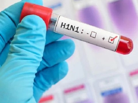 “Xəstə şagird məktəbə getsə, gec sağalıb ağırlaşmaları yaranacaq” – Deputatla həkimin “gürcü təlaş”ına reaksiya