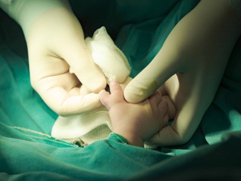 Tibb Universitetinin Tədris Cərrahiyyə Klinikasında altıbarmaqlı uşaq əməliyyat olunub  