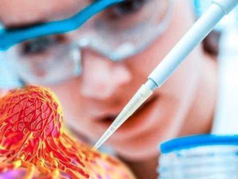 Xərçənglə mübarizədə yeni üsul tapıldı