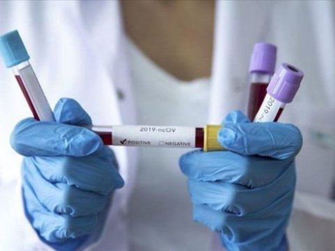 Koronavirusu daha rahat keçirməyin üsulu məlum oldu