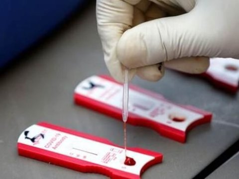 COVID-19-un ikinci dalğasının yayılacağı 10 ölkənin adı açıqlandı