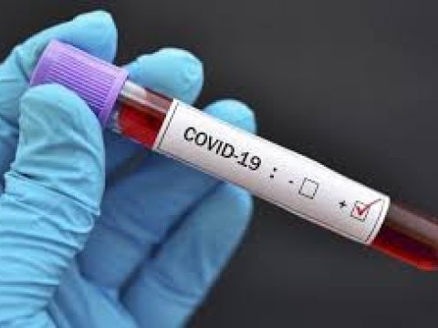 MİQ-də iştirak edəcək bütün namizədlər COVİD-19 testindən keçiriləcək-RƏSMİ