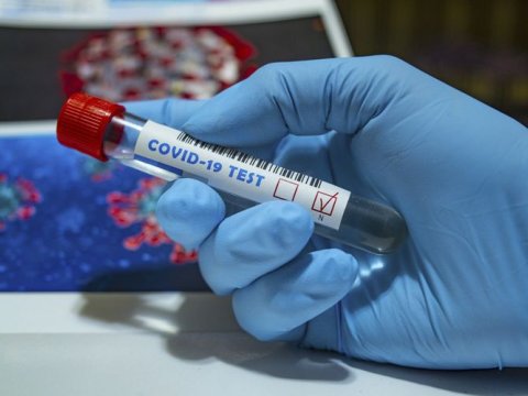 Müəllimlərdən COVİD-19 testindən keçmək tələb olunacaq? – Yalnız bir halda…