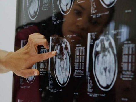 Uşaqların nitq duyumunda beyinin hər iki yarımkürəsi iştirak edir