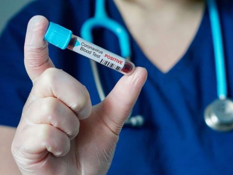 Mətbuat katibi koronavirusa yoluxdu - FOTO