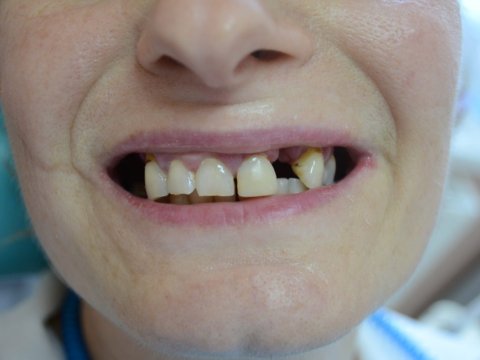 Şagird dişini sındırdı, məktəb cərimələndi