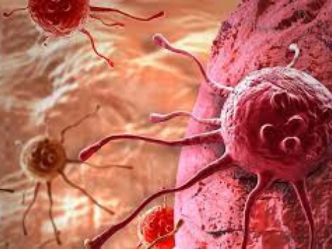 Süni intellektdən xərçəngin müayinəsində istifadə edilə bilər