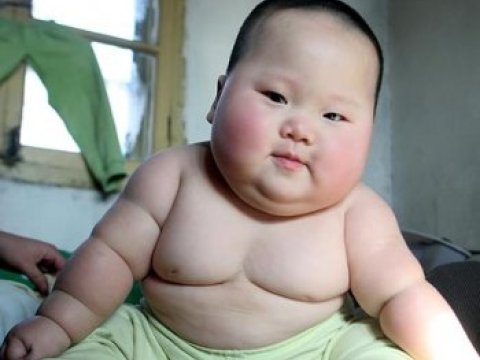 2035-ci ilə qədər piylənmədən əziyyət çəkən uşaqlar 70 faiz artacaq