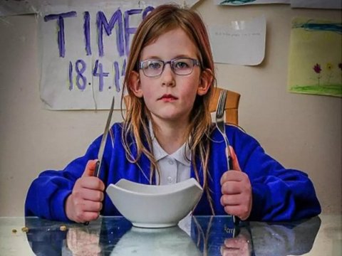 Alimləri şoka salan 13 yaşlı qız - Dünyada ilk dəfə...