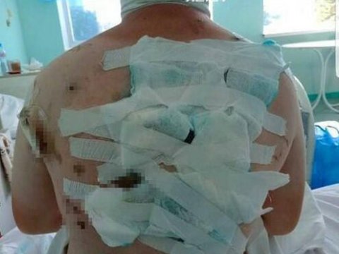 70 yerindən bıçaqlanan şagird danışdı