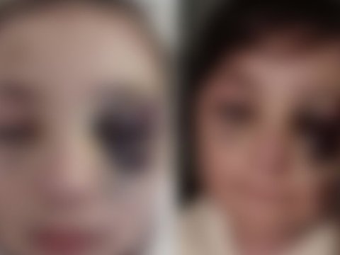 Prokurorluq Bakıda məktəblinin xəsarət alması faktını araşdırır