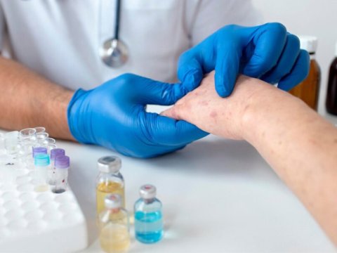 AZTU- da tələbələr arasında qızılca AŞKARLANDI