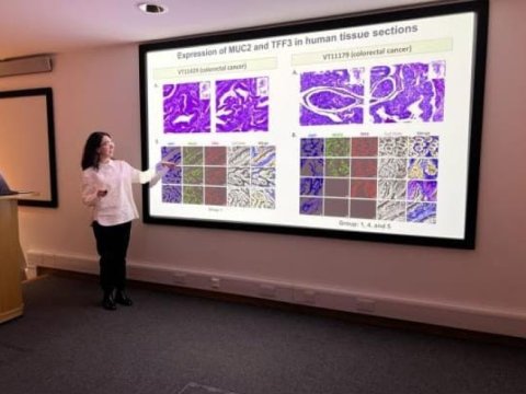 MBBİ-nin magistraturasının məzunu Oksford Universitetində dissertasiya müdafiə edib