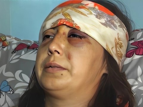 Bətnindəki körpə qızdı deyə hamilə qadını döydülər - Uşaq tələf oldu