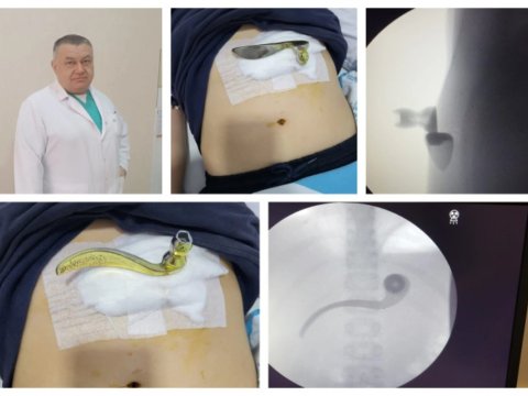 Məktəbdə bədbəxt hadisə: Qapının&nbsp;dəstəyi şagirdin qarnına batıb&nbsp;