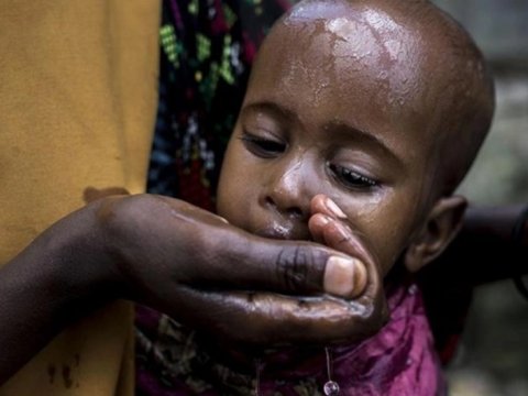 Sudanda vəba qurbanlarının sayı 1 258 nəfərə çatıb