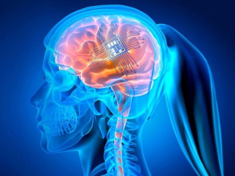 ABŞ-də növbəti şəxsə "Neuralink" beyin çipi yerləşdirilib