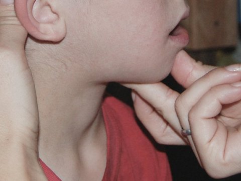 Uşaq cərrahı çöpçülərlə bağlı valideynlərə müraciət edib