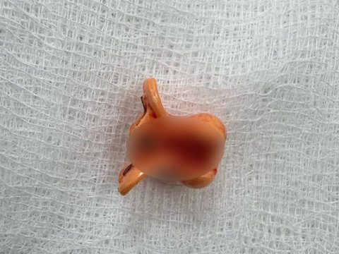 2 yaşlı uşaq saç sancağı uddu&nbsp;