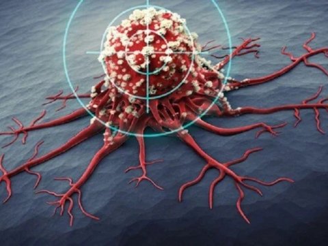 Xərçəngin müalicəsində gözlənilməz yeniliklər