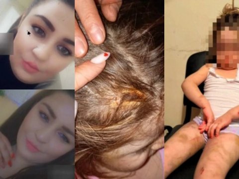 Azyaşlı qızına vəhşicəsinə işgəncə verən ana HƏBS EDİLDİ