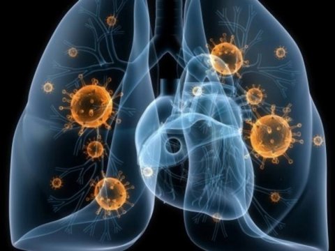 Bu gün Vərəmlə Mübarizə Günüdür