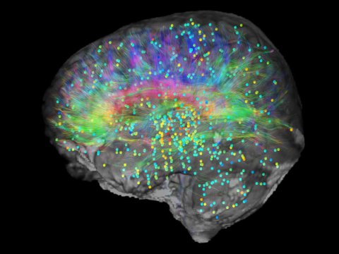 Şüurun beynin hansı hissəsində yarandığı ARAŞDIRILIB