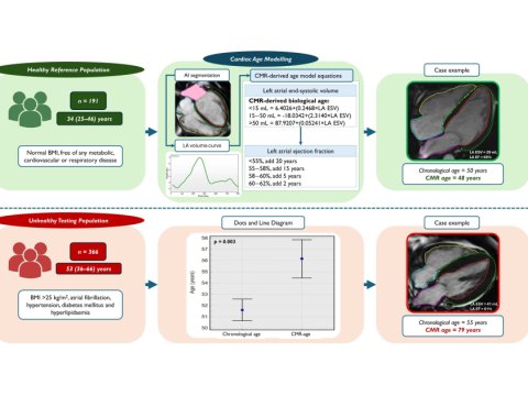 Tədqiqat ürək xəstəliklərinin diaqnozuna yeni yanaşma təklif edir