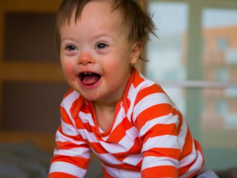 Daun sindromunun səbəbləri: hamiləlikdə nələr risk yaradır?