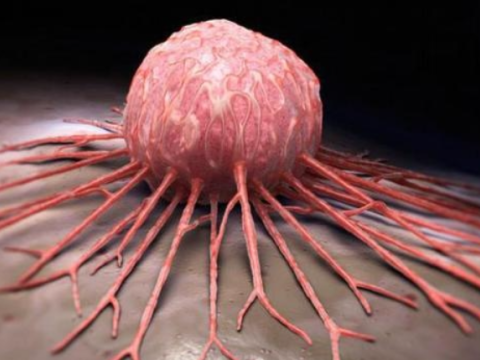 Xərçəng hüceyrələrinin gizli silahı tapıldı