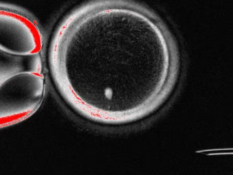 Dəri hüceyrələrindən insan yumurtası yaradıldı