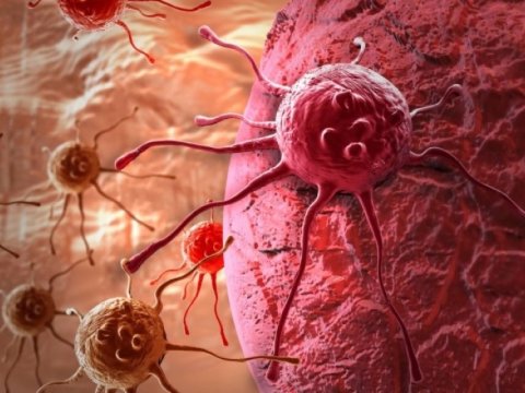 Xərçəngin yayılmasının qarşısını ala bilən&nbsp;peyvənd hazırlanıb