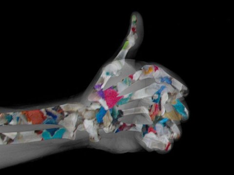 Alimlər insan sümüklərində mikroplastiklər aşkarlayıb