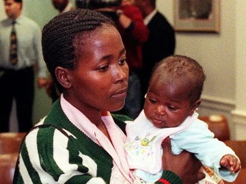 Ağacda doğulan &ldquo;möcüzə uşaq&rdquo; 25 yaşında vəfat etdi