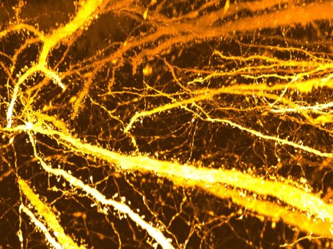 Alimlər xroniki yaraların müalicəsində yeni üsul tapıblar