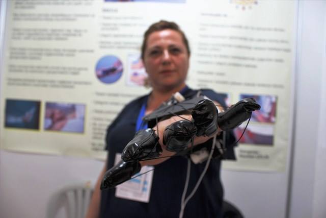 İflic xəstəliyindən əziyyət çəkən şagird müalicə robotu ixtira etdi